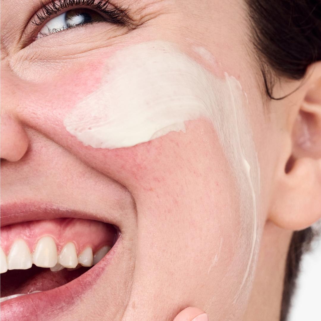 Rednes Solutions Daily Cream- Kızarık Ciltler için Günlük Krem