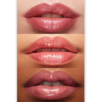 L&