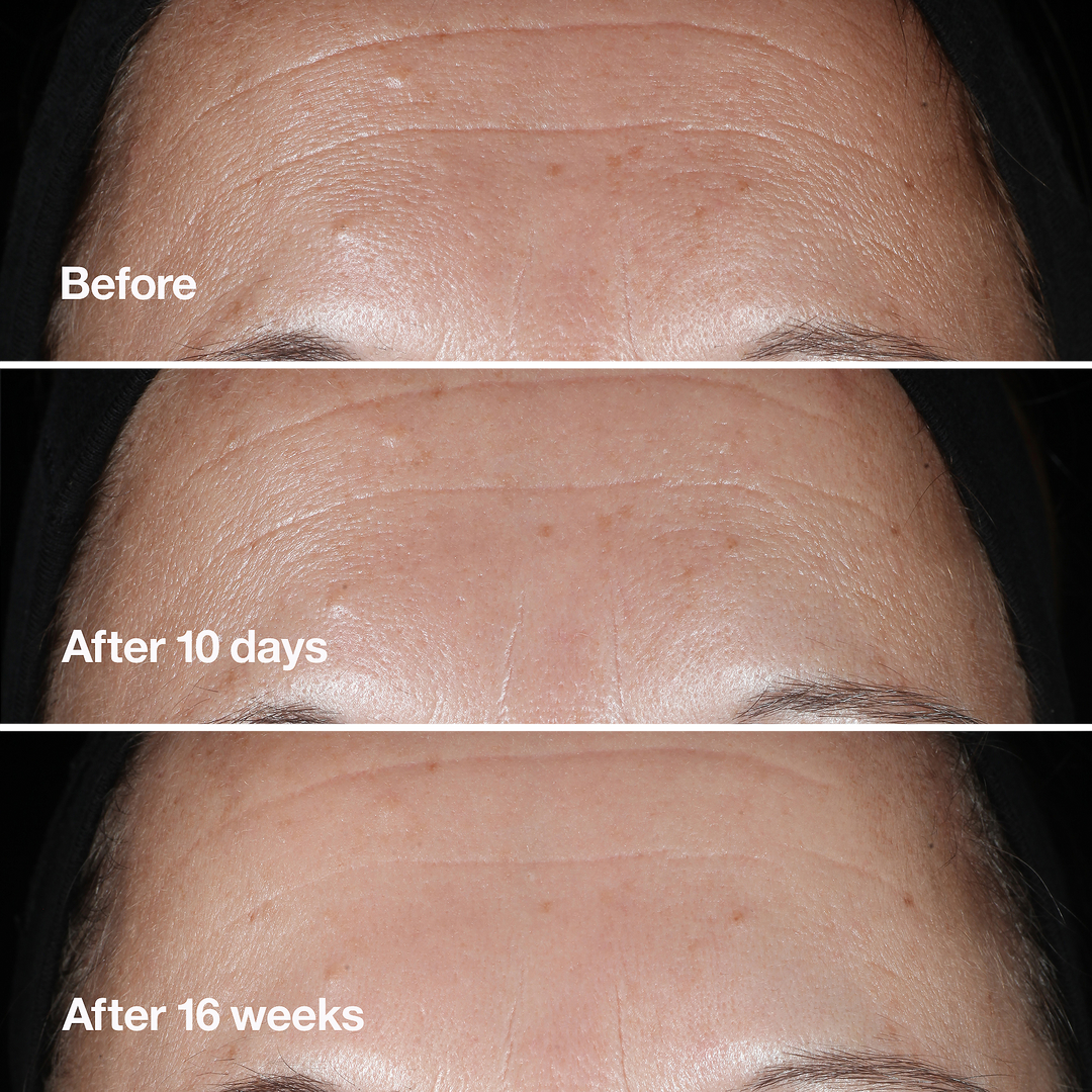Smart Clinical Repair -  Kırışıklık Görünümü Karşıtı Serum