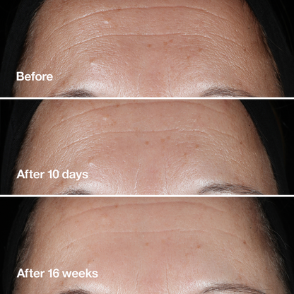 Smart Clinical Repair -  Kırışıklık Görünümü Karşıtı Serum