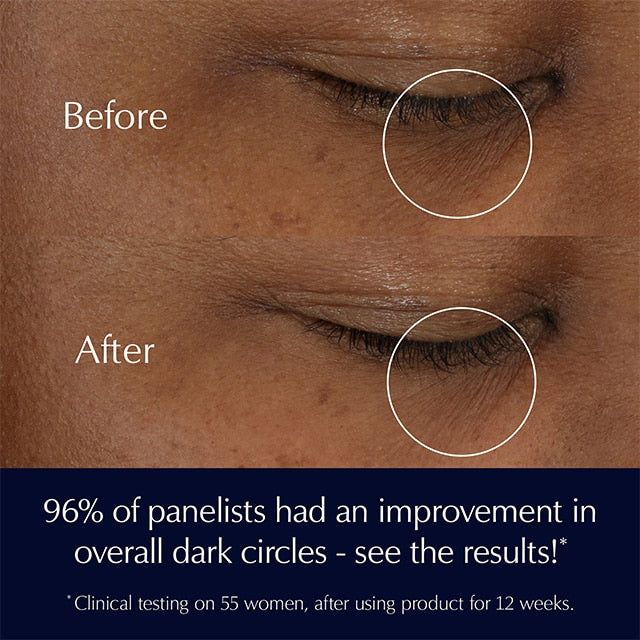 Advanced Night Repair Supercharged Eye Gel-Cream - Jel Göz Kremi